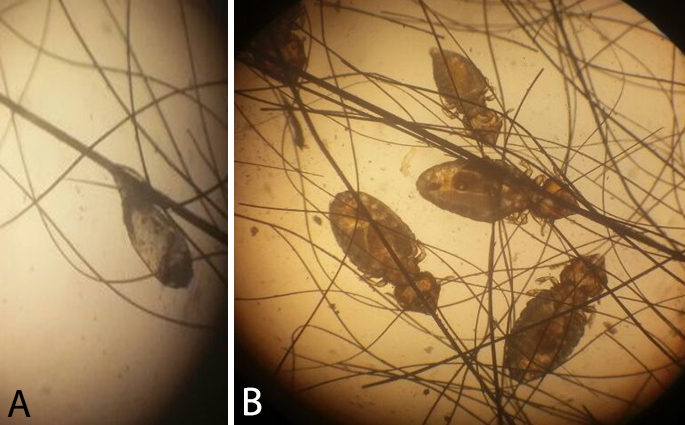 Infestação em Felis catus por Felicola subrostratus